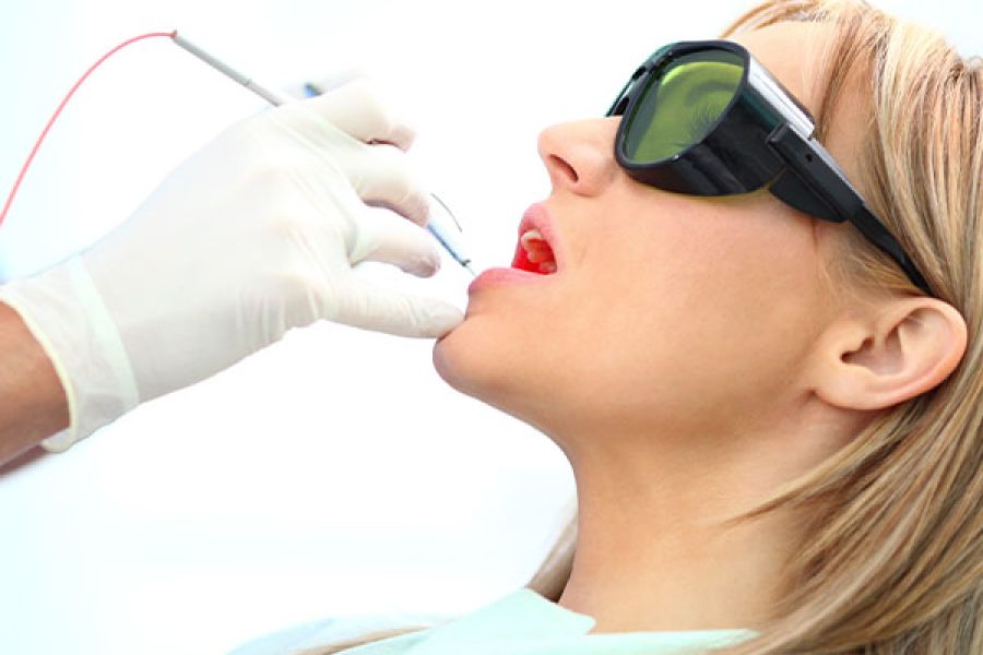 Diodenlaser